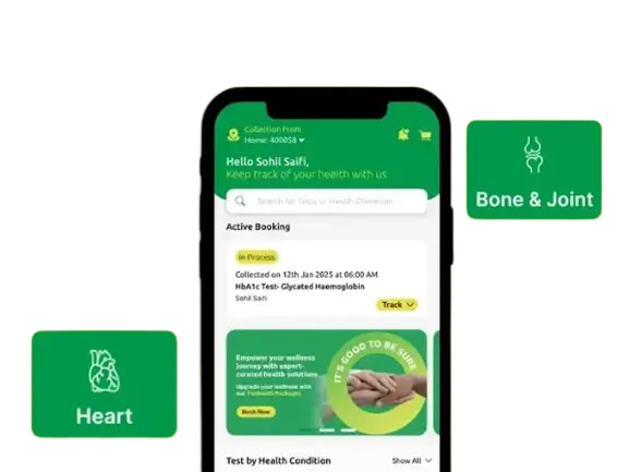 Metropolis mobile app preview on phone