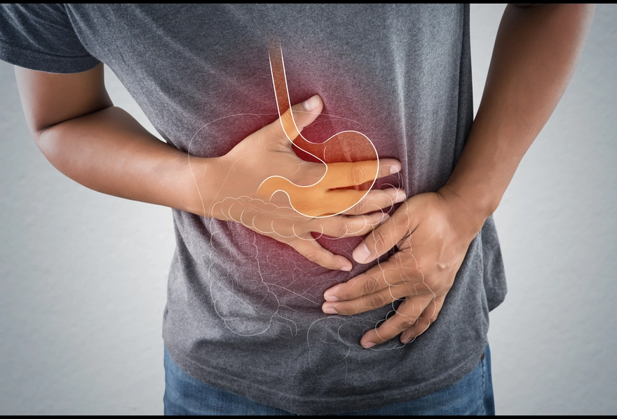 Acid Peptic Disease: Causes, Symptoms, and Treatment