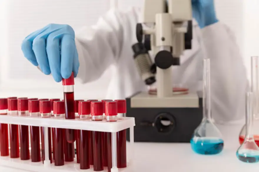 ACTH Stimulation Test: Diagnosing Adrenal Insufficiency