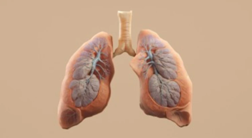 Acute Respiratory Distress Syndrome (ARDS): Causes, Treatment & Recovery