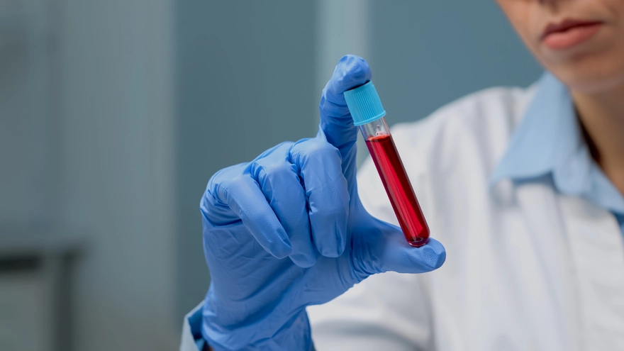 AEC Test (Absolute Eosinophil Count): When and Why It's Ordered