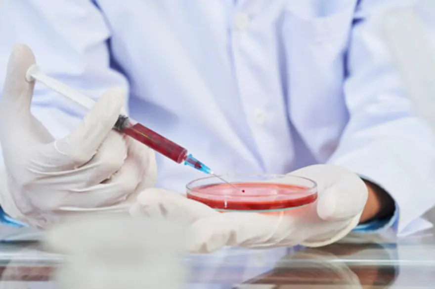 Albumin Blood Test: Understanding Your Protein Levels