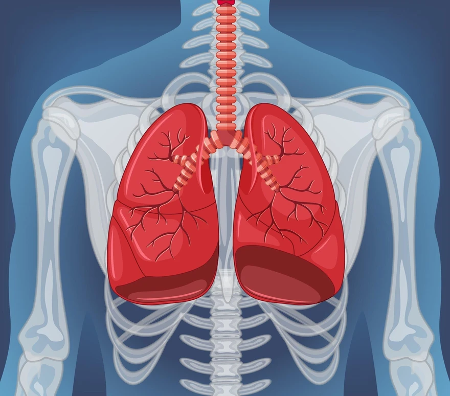 Managing Pneumothorax (collapsed lung): Symptoms, Types, Causes and Treatment