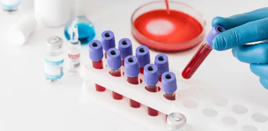 Ammonia Test: When Is It Ordered & What Does It Detect?