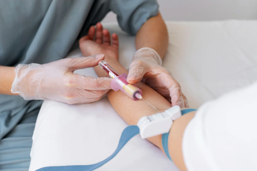Anti-dsDNA Blood Test: What It Is, Results, Procedure,