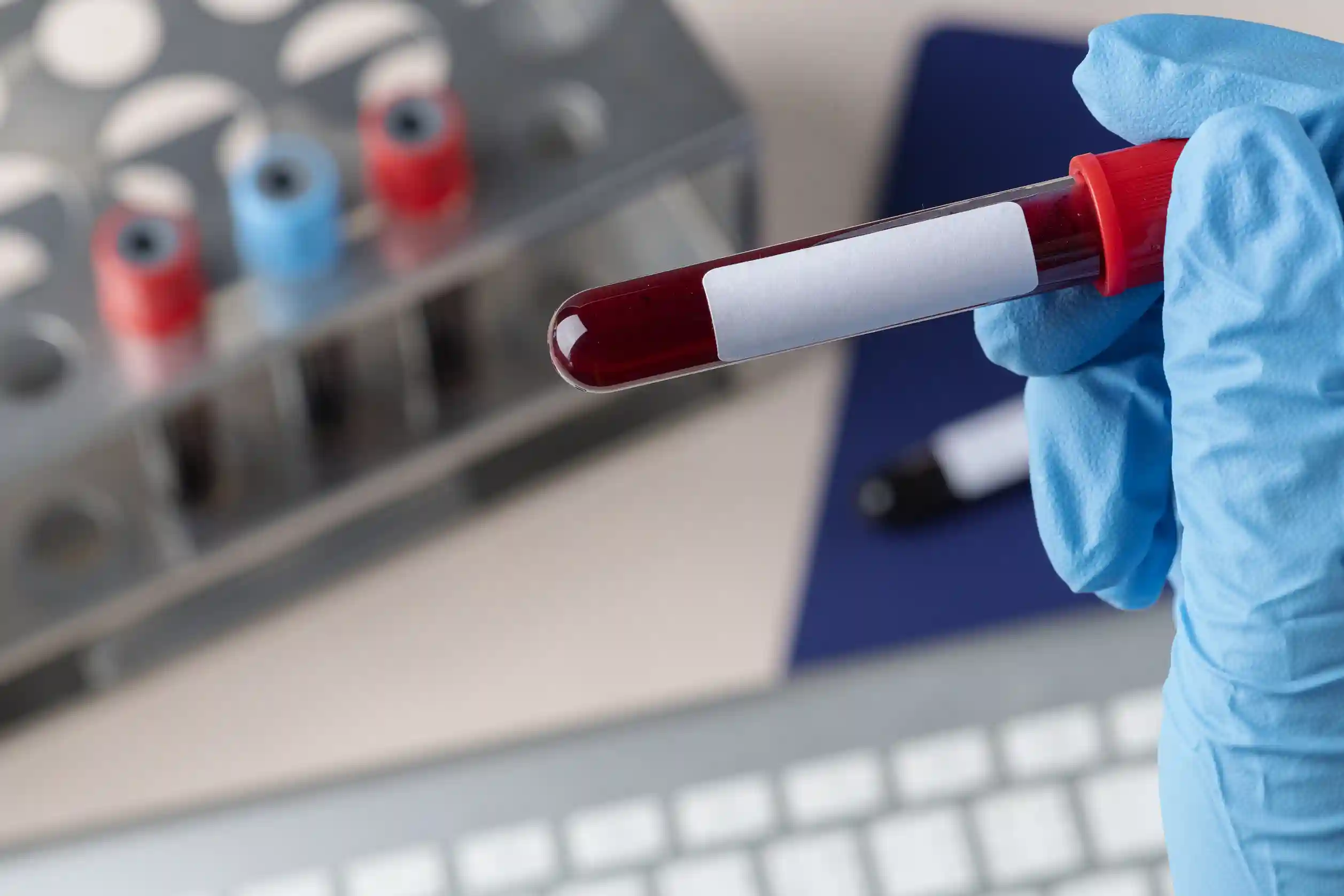 BAC Test: How Blood Alcohol Levels Are Measured And Why It Matters