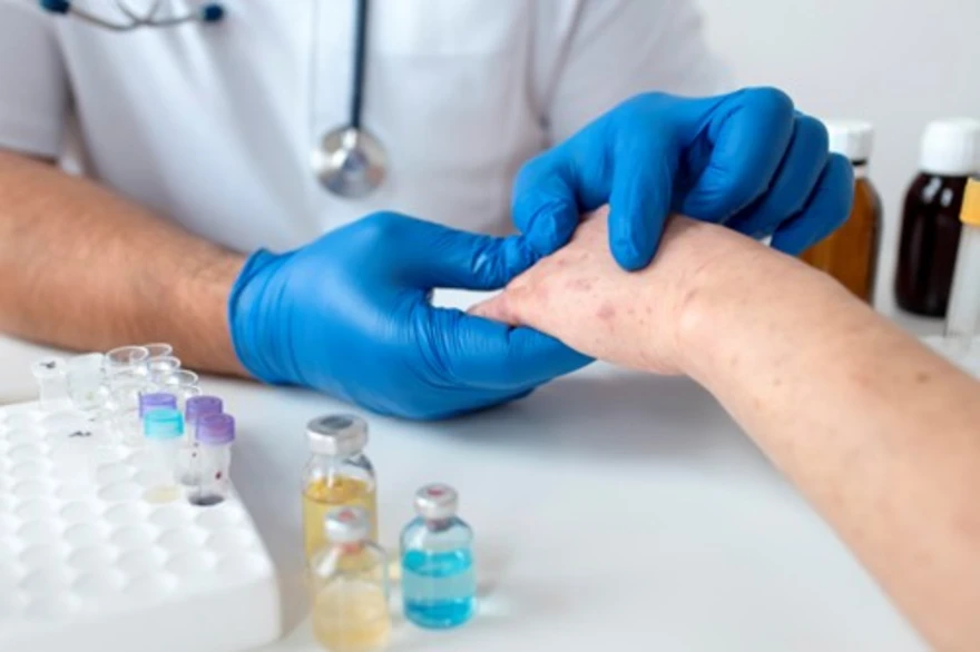 Basal Cell Carcinoma: Spotting It Early & Treatment Approaches
