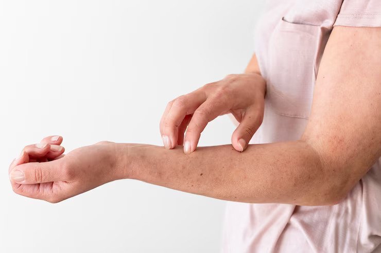 What is Beriberi?: Symptoms, Causes, Treatment & Types