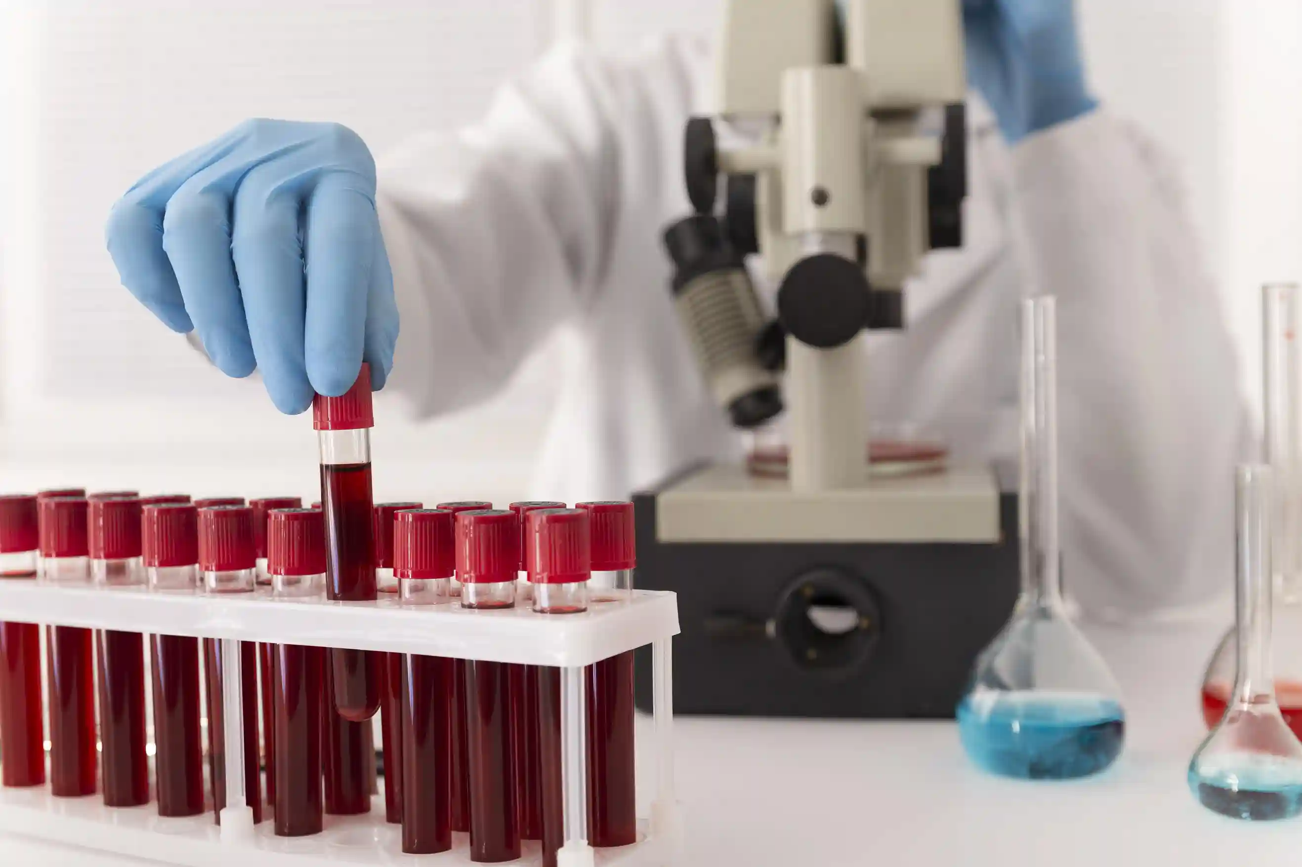 Bicarbonate Blood Test: Understanding Your Acid-Base Balance