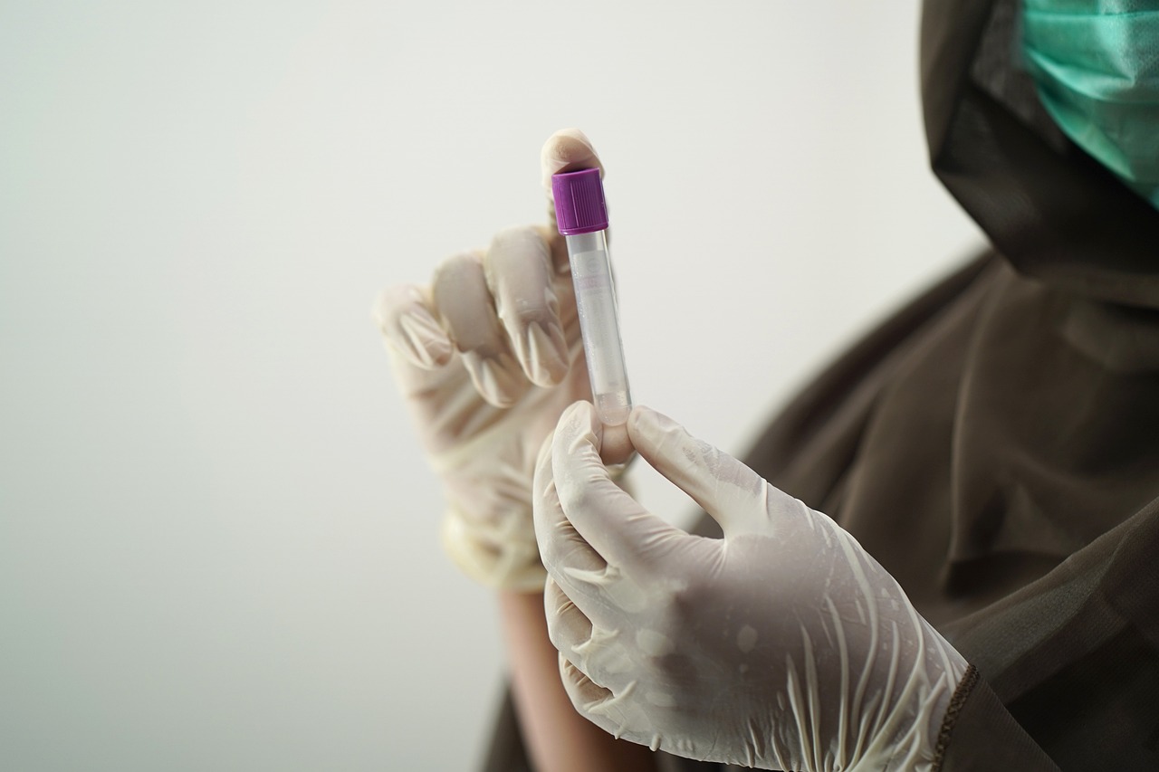 Lupus: Its Symptoms, Treatment & Testing