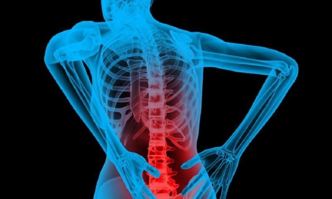 Bone Tuberculosis TB: Symptoms, Causes, Types, Treatment & Diagnosis