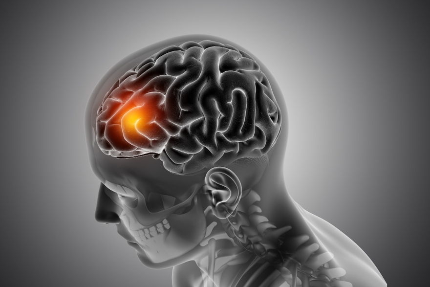 Brain Tumours: Its Types, Symptoms, Causes & Treatments
