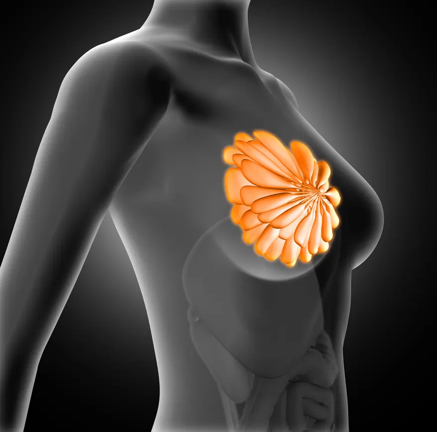 Fibroadenoma: What You Need to Know About Breast Lumps