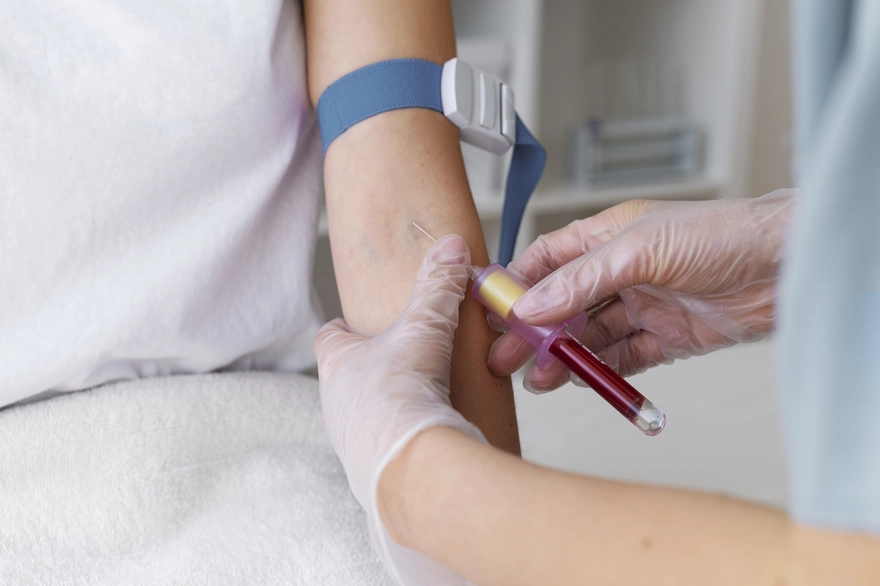 C4 Complement Blood Test: Role in Autoimmune Diagnosis