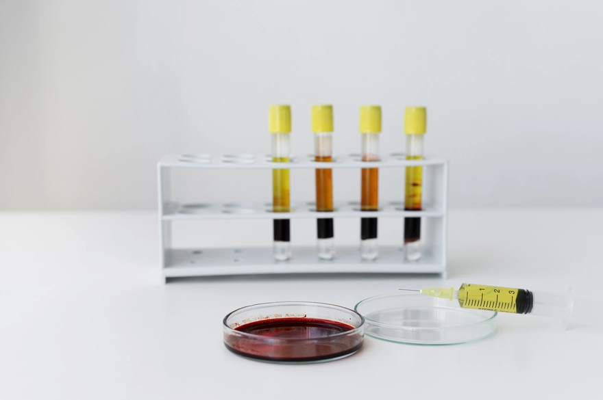 Catecholamines Test: Diagnosing Hormonal Imbalances