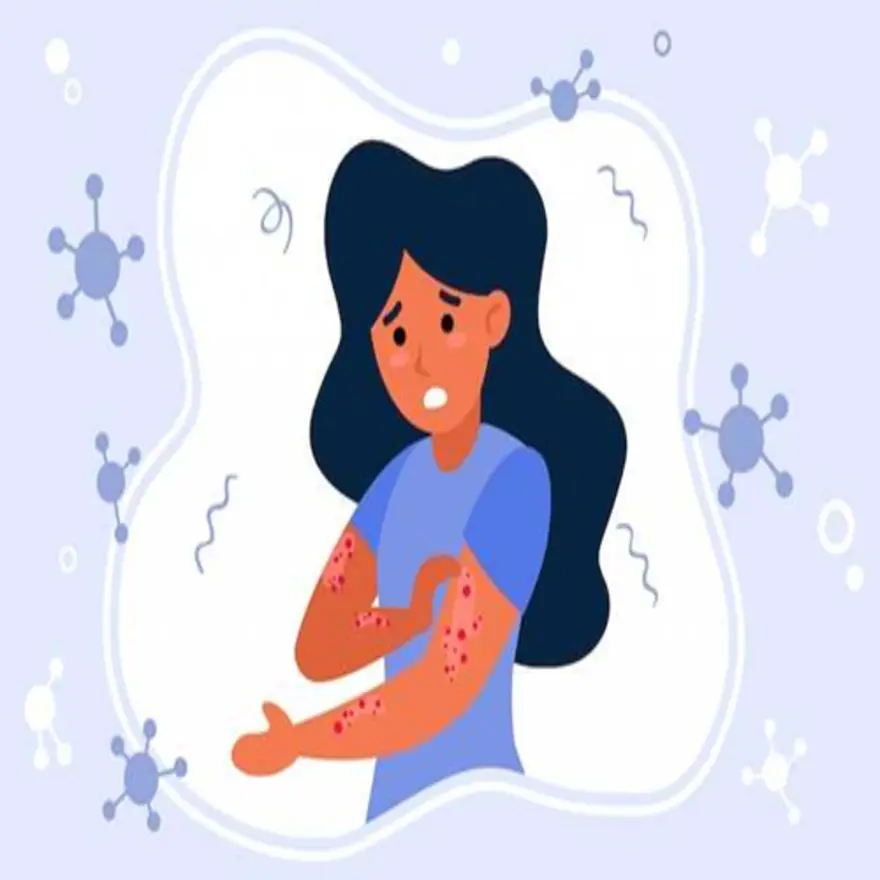 What is Pityriasis Rosea? Symptoms, Causes, and Remedies