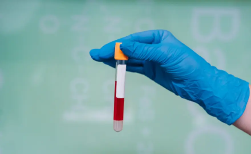 CD4 Test: What It Is and Why It Matters in HIV Management