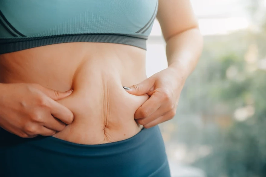 Addressing Cellulite: Causes, Treatment, and Lifestyle Changes