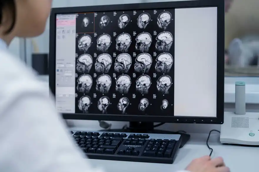 Cerebral Atrophy: Causes, Symptoms, Diagnosis and Treatment Options