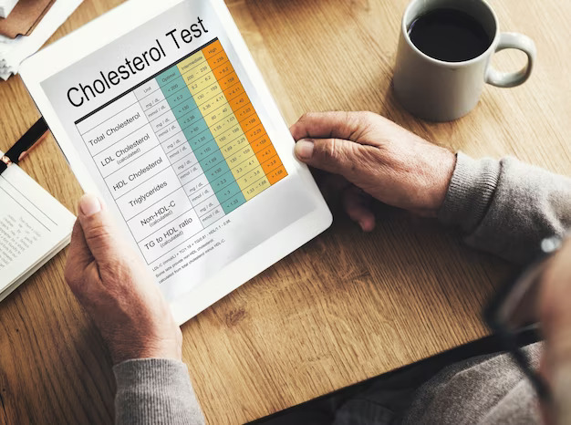 Cholesterol Levels: By Age Chart Benefits & Ways to Maintain Normal Cholesterol Levels