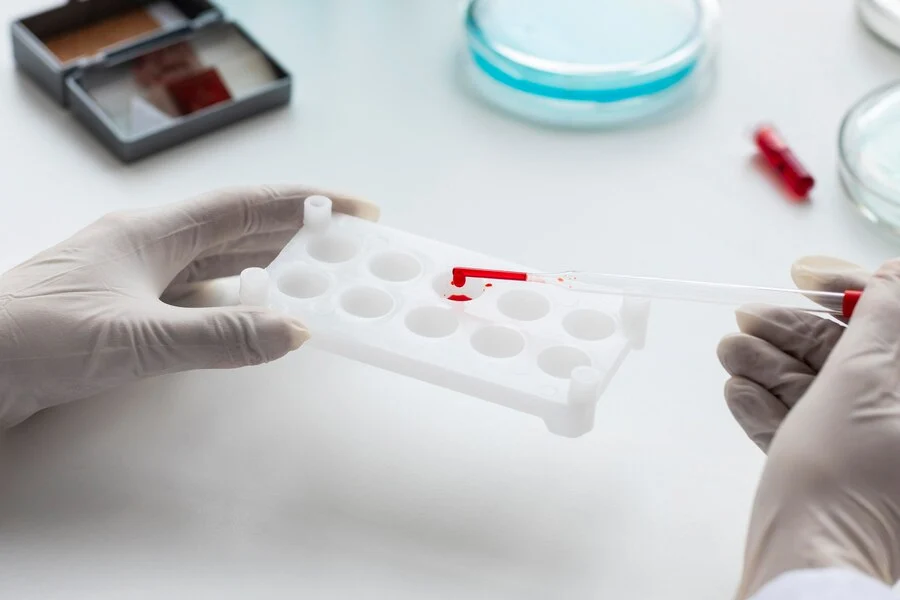 Blood Group Testing: Types, Procedure