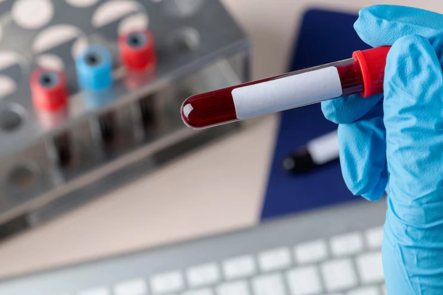 CO2 Blood Test: Purpose, Procedure & What Your Results Mean
