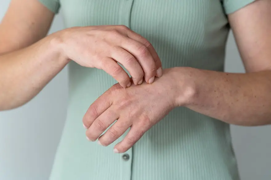 Defeating Contact Dermatitis: Unveiling Causes, Symptoms, and Solutions
