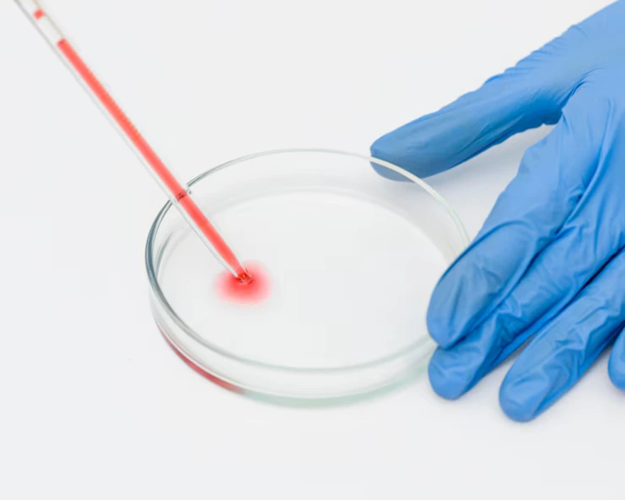 Coombs Test: What It Detects and When You Need It