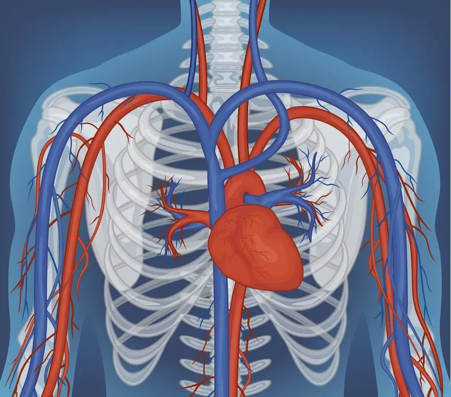 What is Coronary Artery Calcification? Risks and Prevention Tips