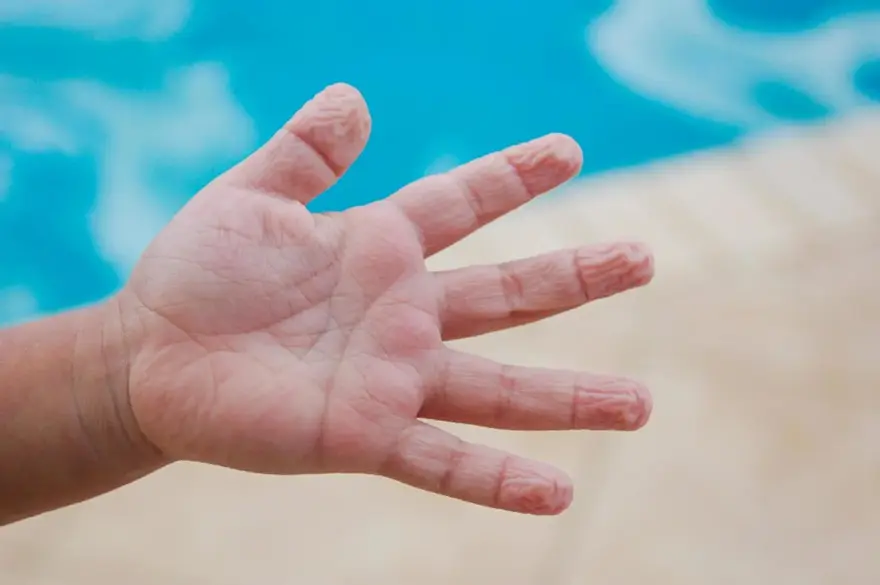 Cyanosis: Understanding the Causes and Treatment of This Blue Skin Condition