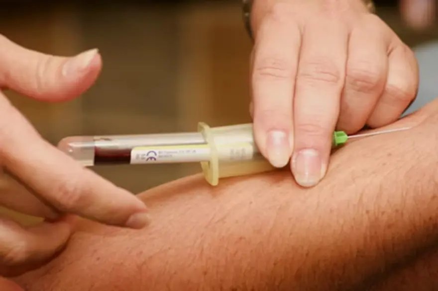 D- Dimer Test: Procedure & Results