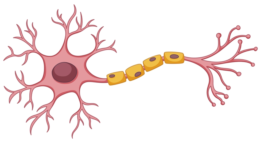 Demyelinating Disease Explained: What You Need to Know