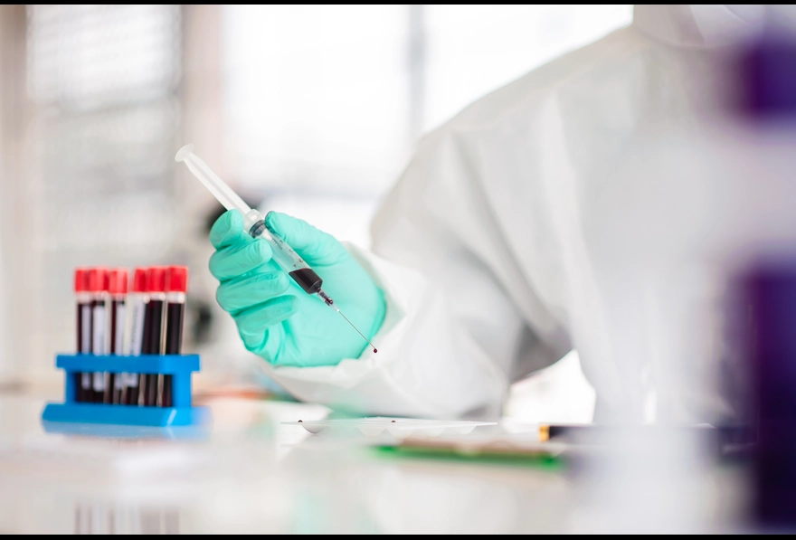 What is Dengue NS1 Antigen Test? When to Get It