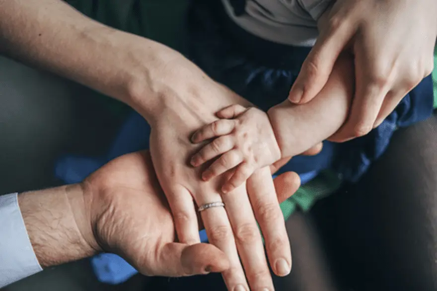 DiGeorge Syndrome: A Comprehensive Guide to Causes, Symptoms, and Treatment