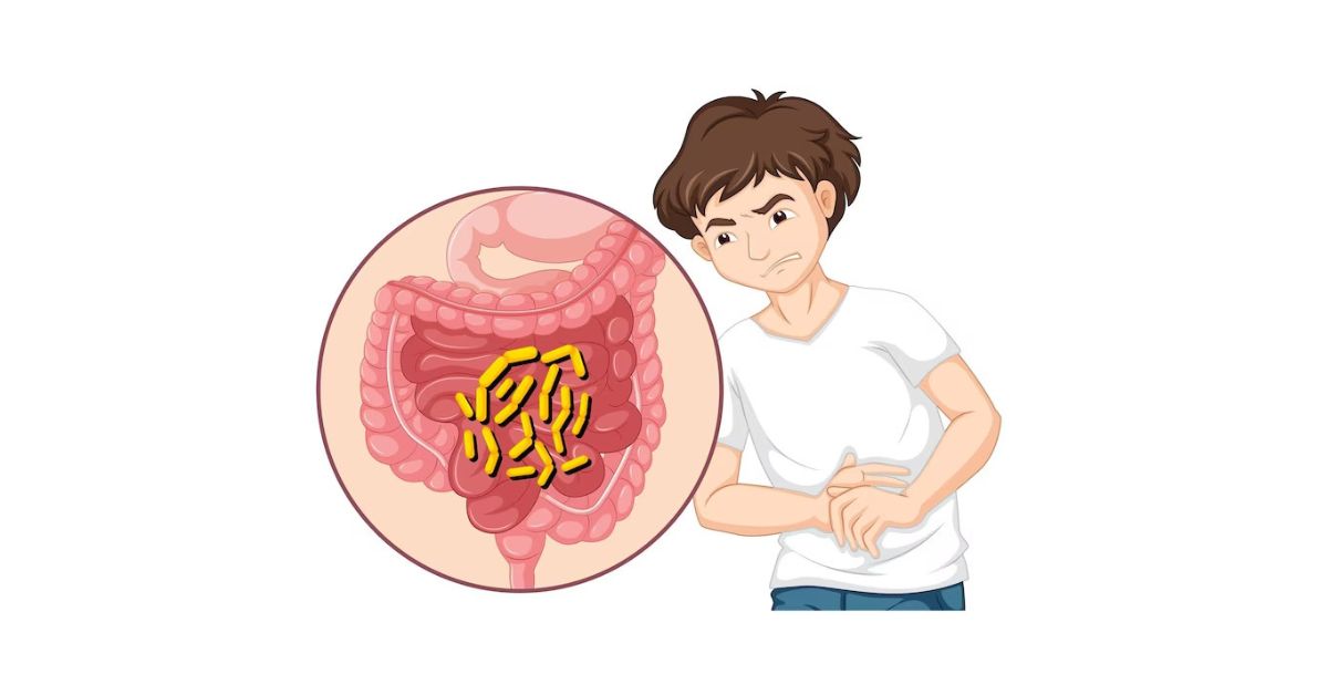 Top 9 Diseases of the Digestive System