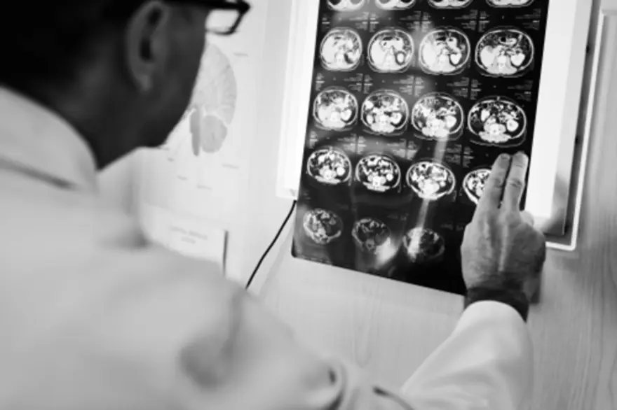 What Is a DNET Tumor? Symptoms & Treatment Guide