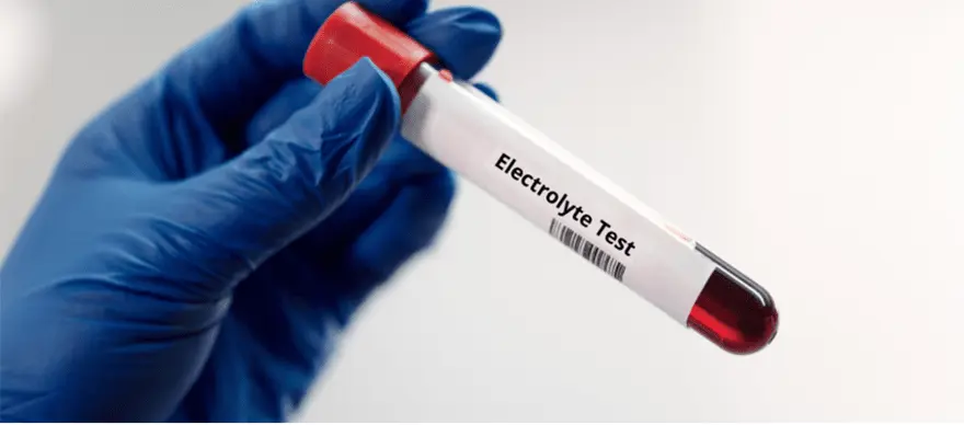 Electrolytes Test: Normal Range, Purpose & Results