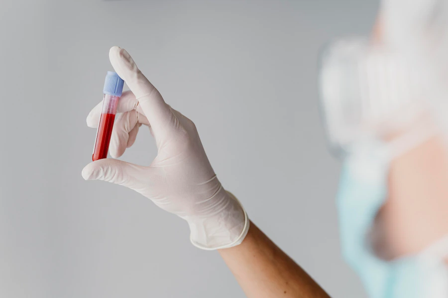What is ELISA Test for HIV Detection?