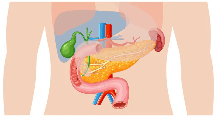 ERCP (Endoscopic Retrograde Cholangiopancreatography)