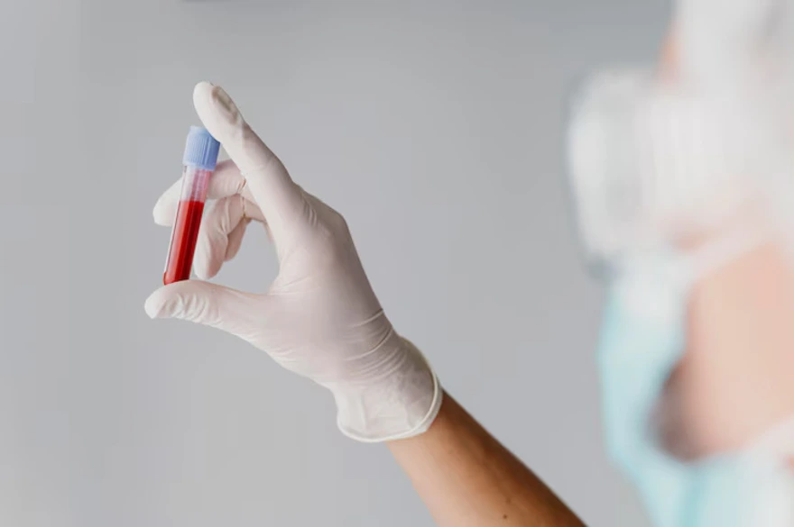 Erythropoietin Test: Detecting Anaemia and Kidney Disorders