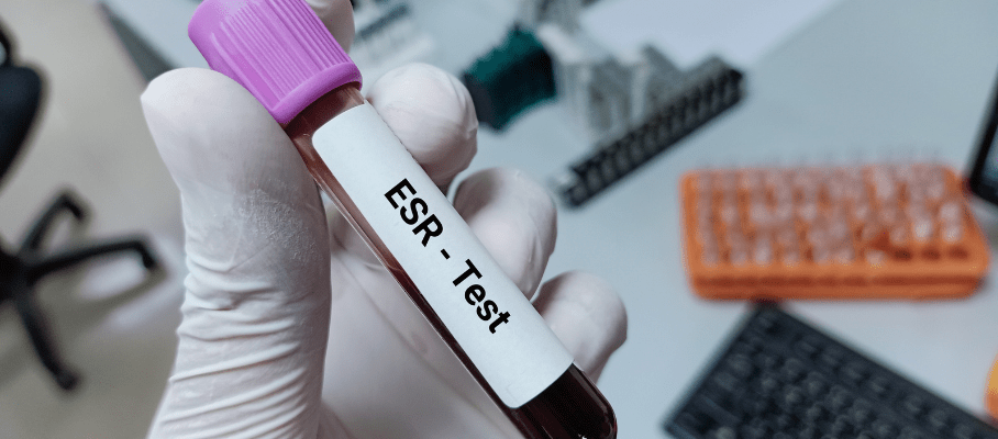 ESR Test: High ESR Levels Explained - Causes, Symptoms & Health Insights