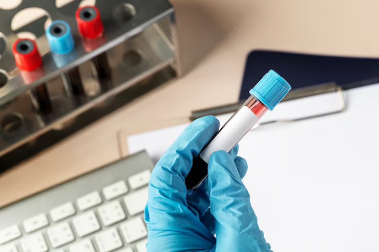 Cytomegalovirus (CMV) Test: Overview, Uses, Risks & Result