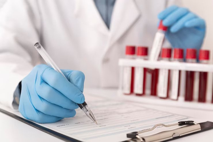 CA 19-9 Blood Test for Pancreatic Cancer