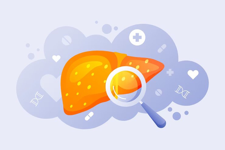 Fatty Liver Diet: Diet to Follow & Prevention of Fatty Liver