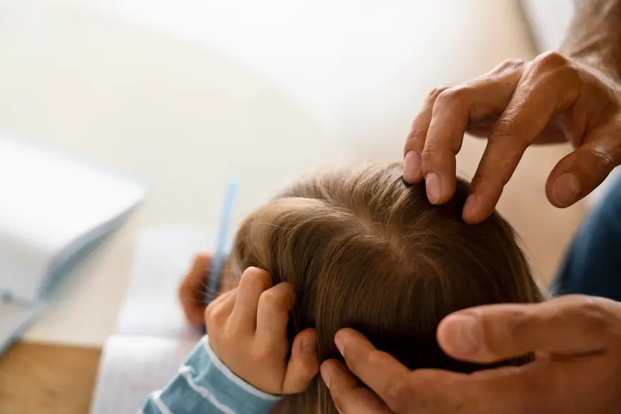 Flat Head Syndrome in Babies: Causes, Prevention, and Treatment