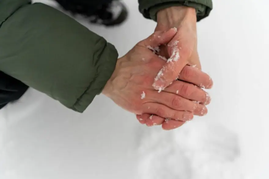 Frostbite: Causes, Symptoms, and How to Prevent It