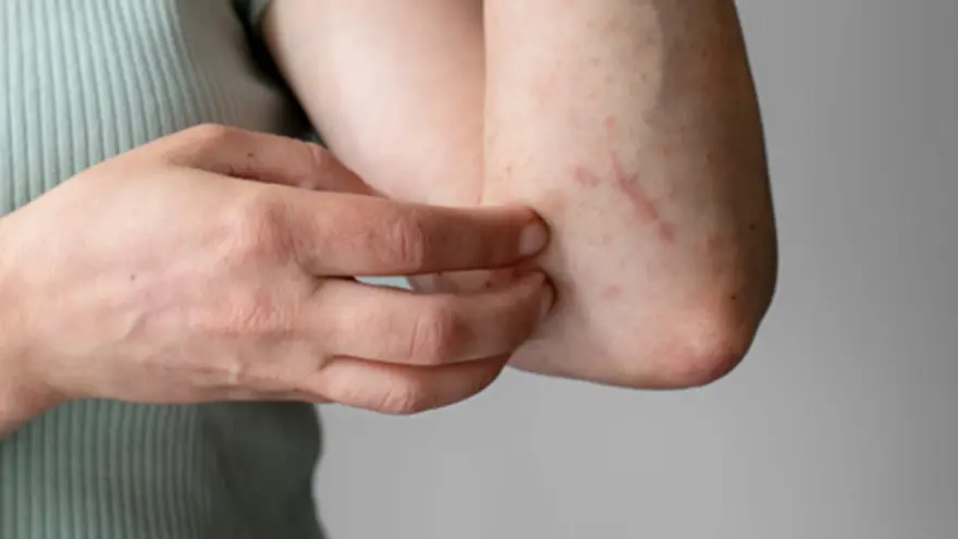 Fungal Disease Awareness Week: Silent Infections & Diagnostic Clues