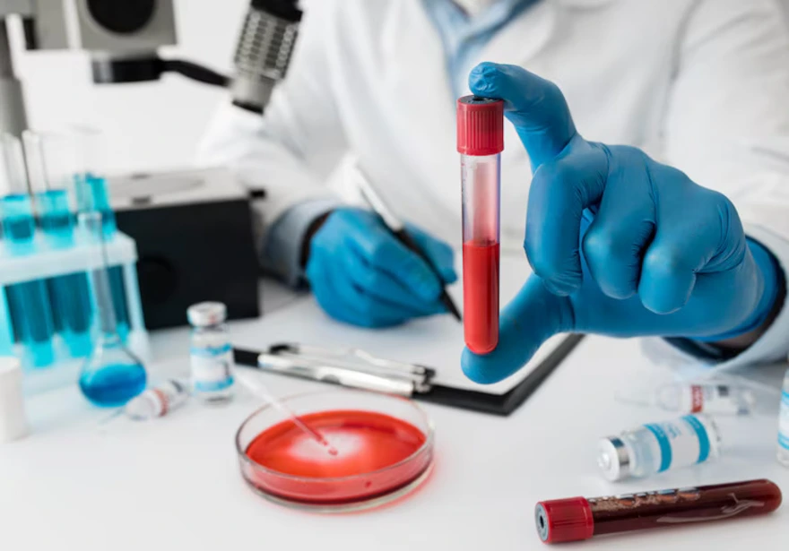 G6PD Test: Detecting Enzyme Deficiency and Avoiding Triggers