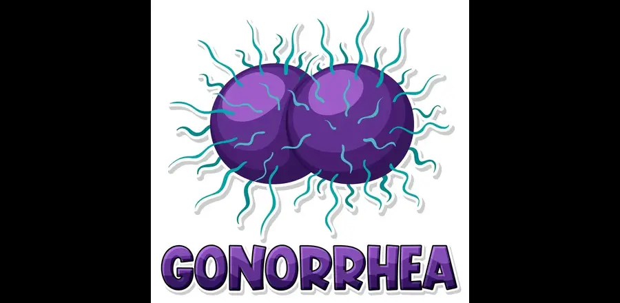 Gonorrhoea - Symptoms, Causes, Diagnosis, Treatment and Prevention