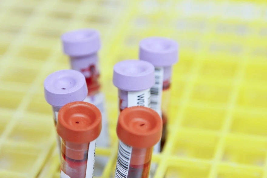 Haemoglobin Electrophoresis: Your Key to Accurate Diagnosis of Blood Conditions